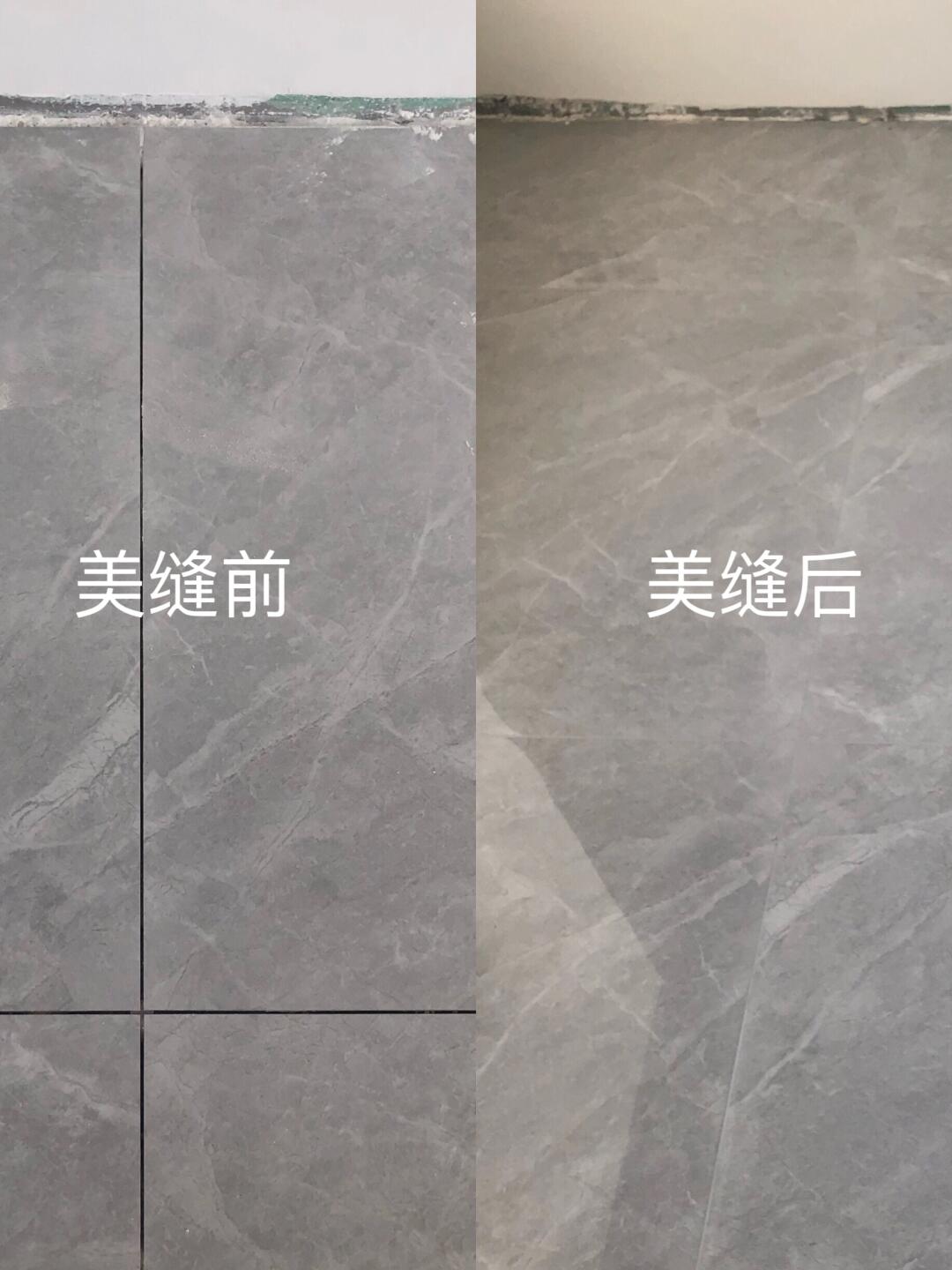 美缝案例分享