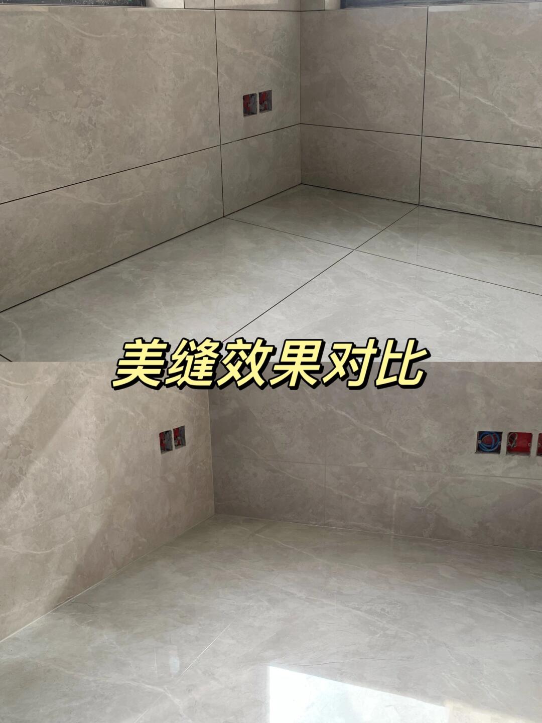 美缝案例分享