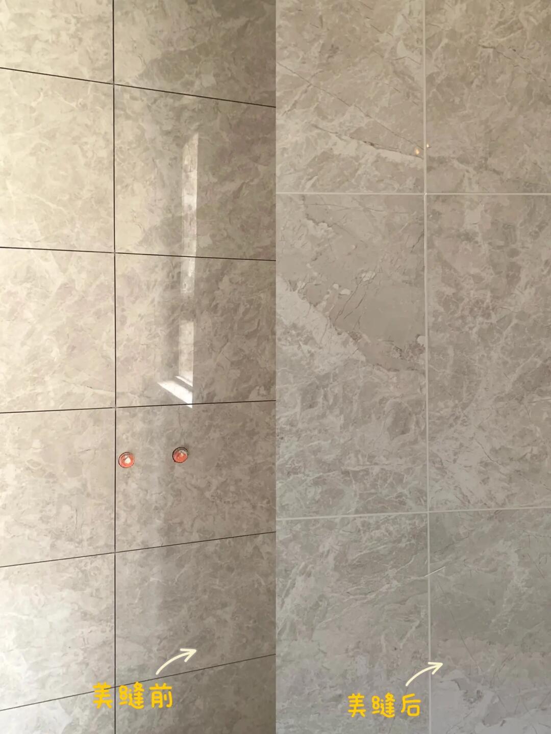 美缝案例分享